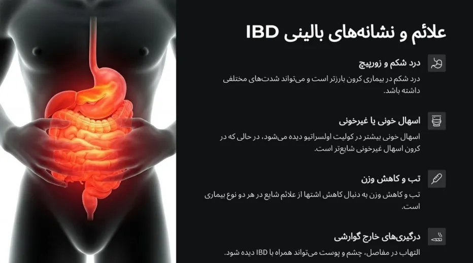 علائم IBD