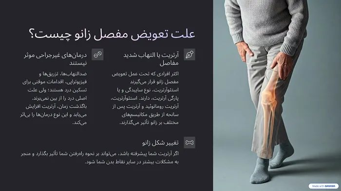 علت تعویض مفصل زانو چیست؟